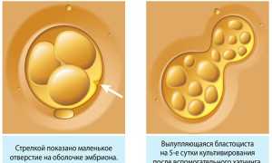 Хетчинг эмбрионов