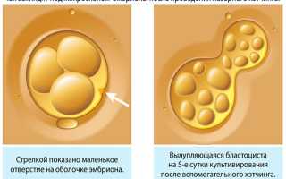 Хетчинг эмбрионов