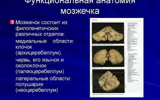 Опухоль мозжечка головного мозга