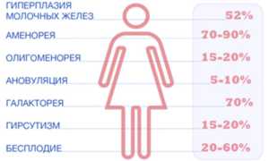 Гиперпролактинемия: как избавиться от болезни