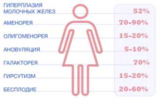 Гиперпролактинемия: как избавиться от болезни