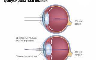 Что такое спазм аккомодации у ребёнка и как его лечить?