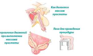 Как делать массаж простаты: подготовка и техника выполнения