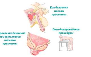 Как делать массаж простаты: подготовка и техника выполнения