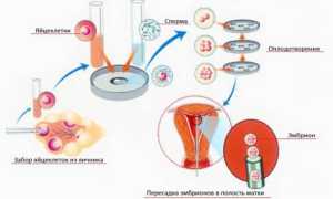Короткий протокол при ЭКО