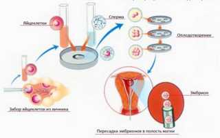 Короткий протокол при ЭКО