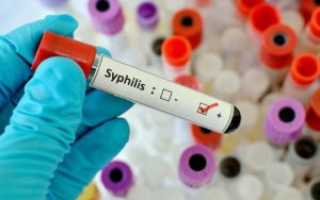 Сифилис, ВИЧ, СПИД и гепатит: в чем разница и какие анализы нужно сдать, чтобы провериться, время для проявления инфекций