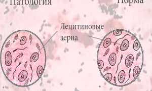 Лецитиновые зерна в секрете простаты: расшифровка анализа, норма, отклонение