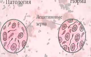 Лецитиновые зерна в секрете простаты: расшифровка анализа, норма, отклонение