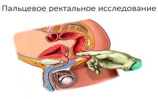 Чем грозит запущенный простатит мужскому здоровью — как предотвратить серьезное заболевание