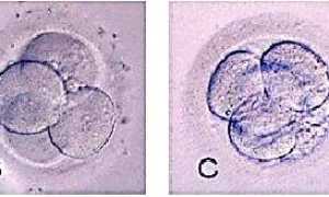 Классы эмбрионов при ЭКО