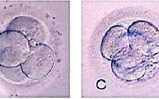 Классы эмбрионов при ЭКО