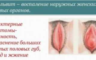 Обзор неспецифических и специфических воспалительных заболеваний женских половых органов
