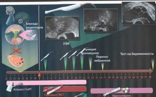 Стимуляция и выбор протокола в ЭКО
