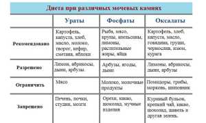 Что такое мочекаменная болезнь — чем опасно заболевания