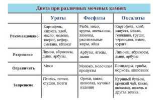 Что такое мочекаменная болезнь — чем опасно заболевания