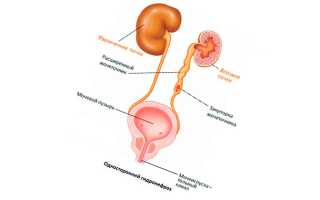 Что такое стриктура мочеточника — угрожающие здоровью последствия