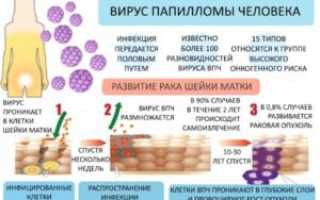 Вирус папилломы человека 51 типа: опасность, источник заражения, диагностика, профилактика, лечение
