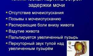 Что такое аденома простаты у мужчин: симптомы, лечение, препараты и профилактика