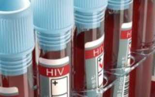 Ложноположительный анализ на ВИЧ: причины, болезни схожие по симптомам, ошибка лаборатории, сдача анализа