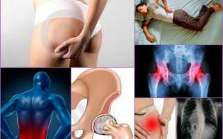 Специфика лечения и симптомы бурсита тазобедренного сустава