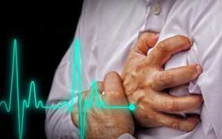 Какое возможно давление при инфаркте миокарда