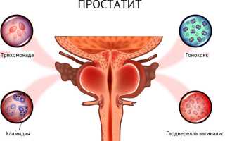 Что такое хламидийный простатит — чем опасно заболевание для мужчин