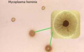 Микоплазма хоминис (mycoplasma hominis): что это такое