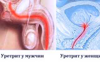 Лечение уретрита народными средствами