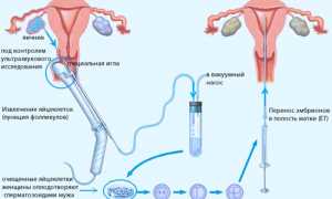Cтимуляция овуляции при ЭКО